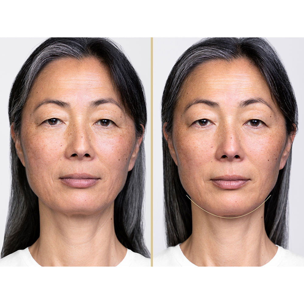 Shiseido Perfeição vital sérum levantamento noturno definir 40 ml