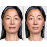 Shiseido Perfeição vital sérum levantamento noturno definir 40 ml