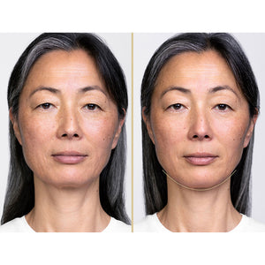 Shiseido Perfeição vital sérum levantamento noturno definir 40 ml