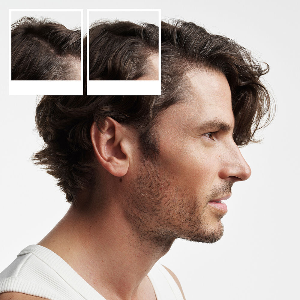 Nioxin Sistema 2 - kit - tratamento para cabelos naturais com enfraquecimento avançado 3 unidades
