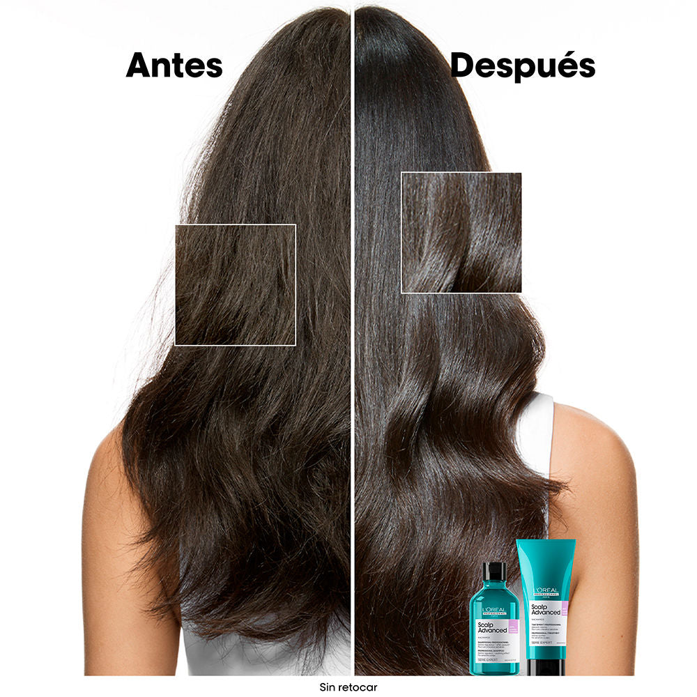 L'Oréal Professionnel Paris Xampu para couro cabeludo sensível refil scalp advanced 500 ml