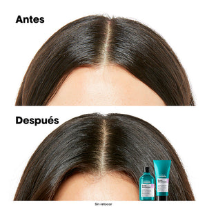 L'Oréal Professionnel Paris Xampu para couro cabeludo sensível refil scalp advanced 500 ml