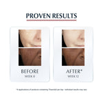 Eucerin Anti-Pigment Dual Sérum 30ml
