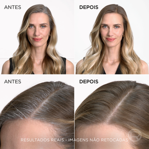 L'Oréal Paris Magic Retouch Spray Bege 75 ml
