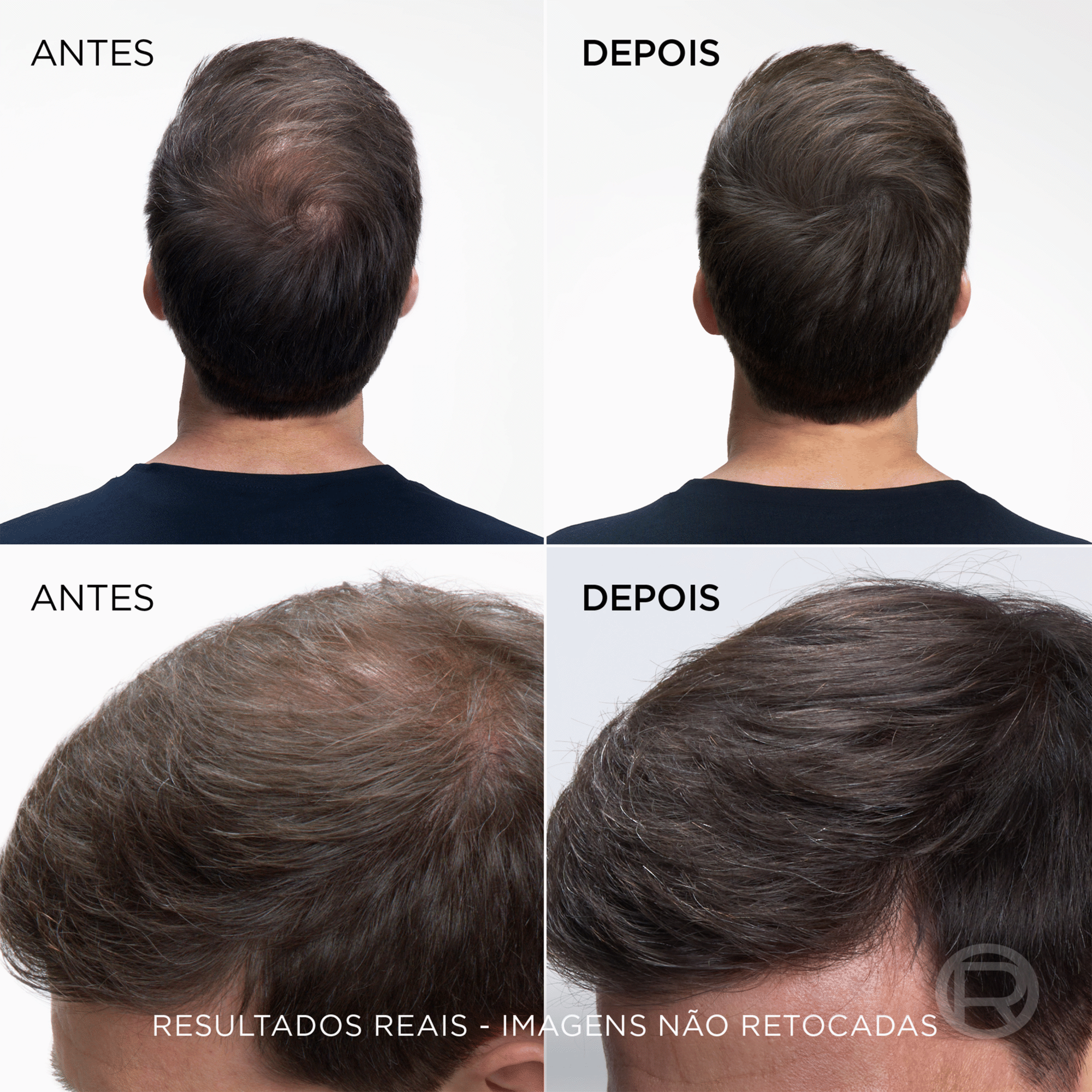 L'Oréal Paris Magic Retouch Acajou 6 75 ml