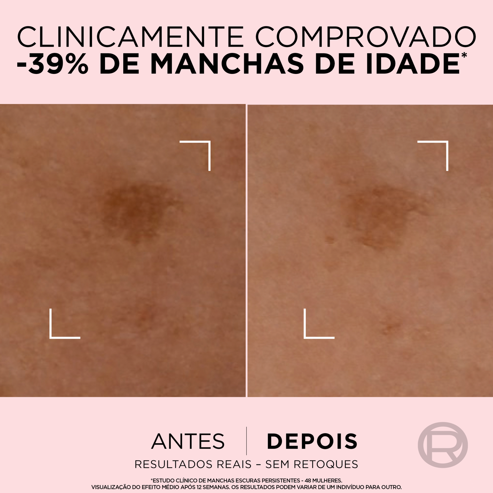 L'Oréal Paris Age Perfect Sérum Anti-Manchas 30 ml