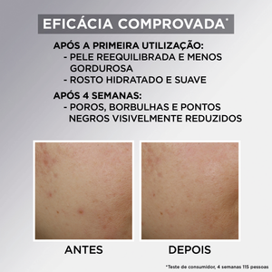 Garnier Skin Active Pure Creme de Dia 50 ml