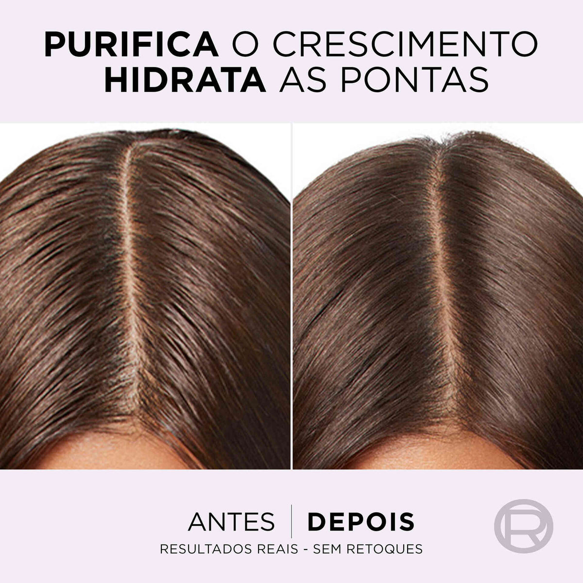 L'Oréal Paris Elvive Hidra Hialurónico Pure 100 ml