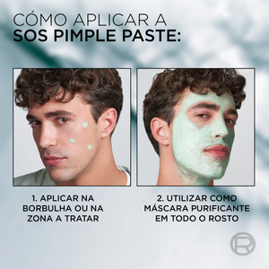 L'Oréal Paris Men Expert Derma Control SOS Pimple Paste 45 ml