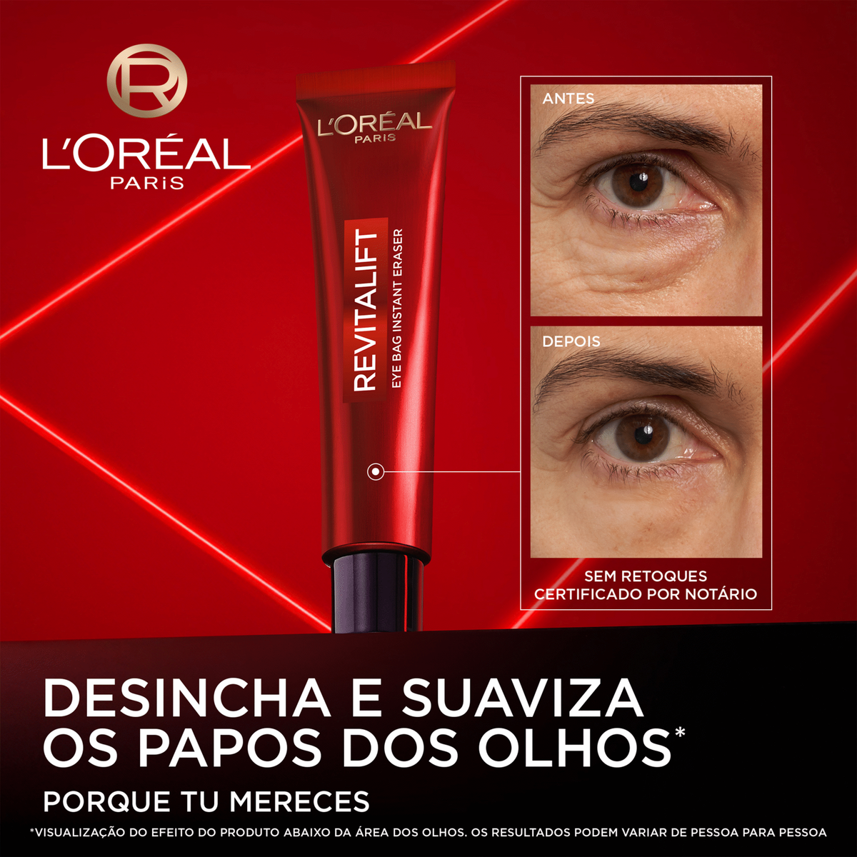 L'Oréal Paris Revitalift Laser Creme de Olhos 15 ml