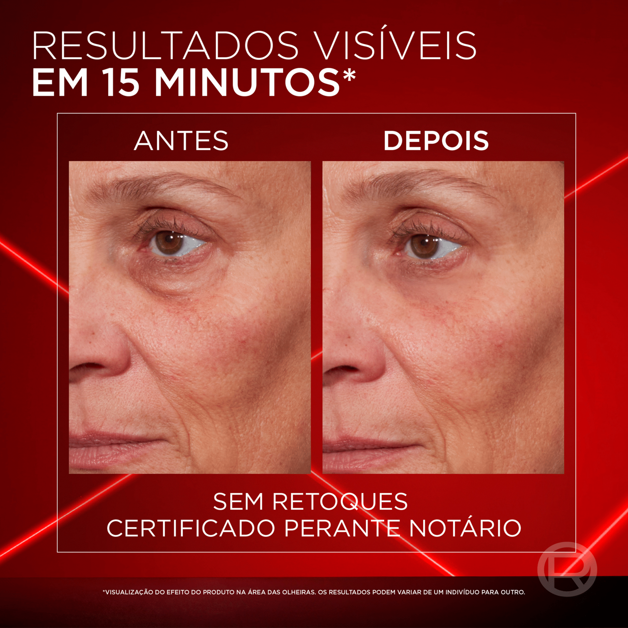 L'Oréal Paris Revitalift Laser Creme de Olhos 15 ml