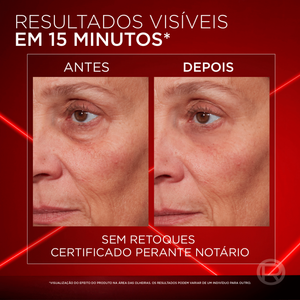 L'Oréal Paris Revitalift Laser Creme de Olhos 15 ml