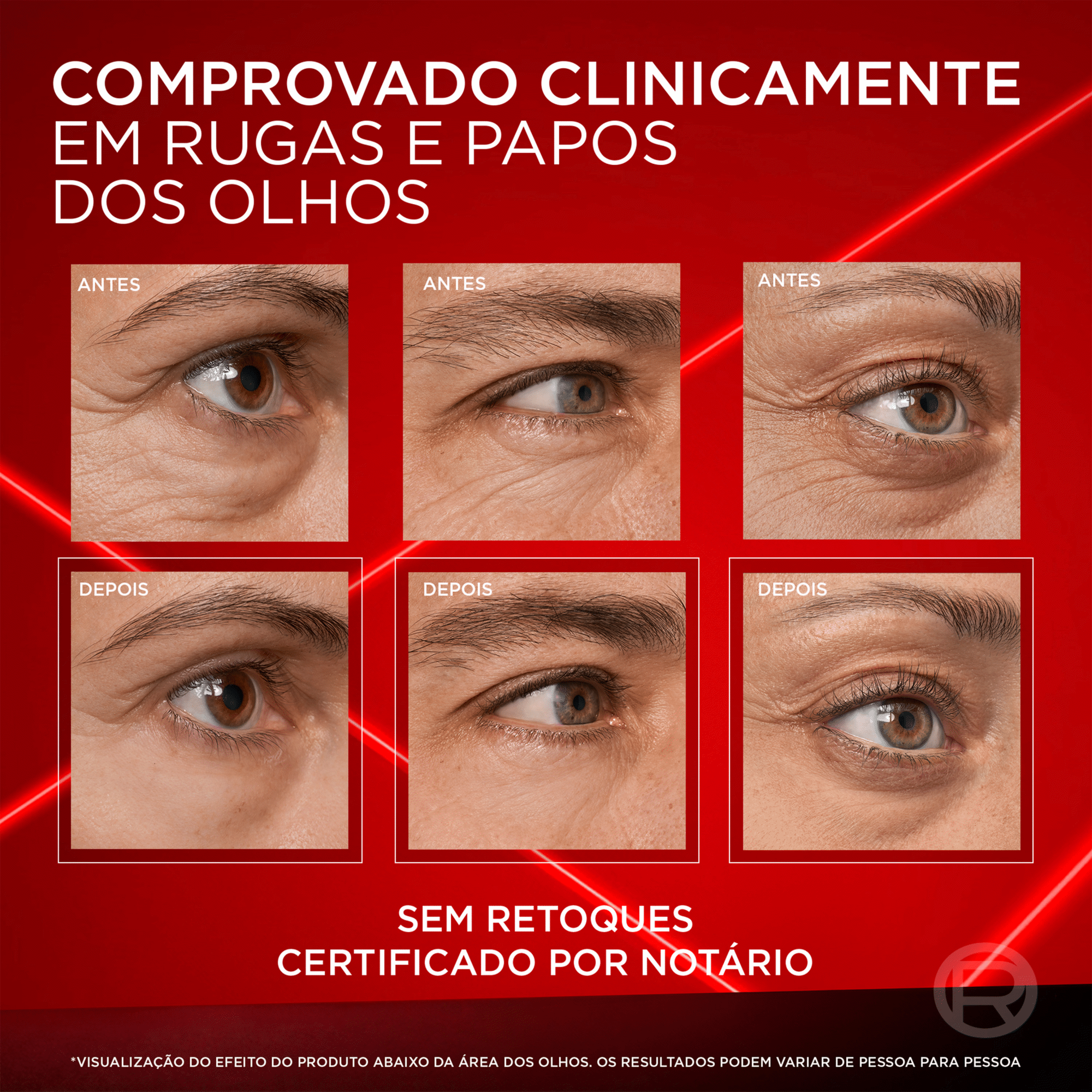 L'Oréal Paris Revitalift Laser Creme de Olhos 15 ml