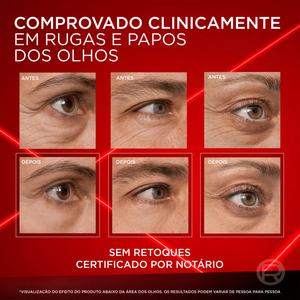 L'Oréal Paris Revitalift Laser Creme de Olhos 15 ml