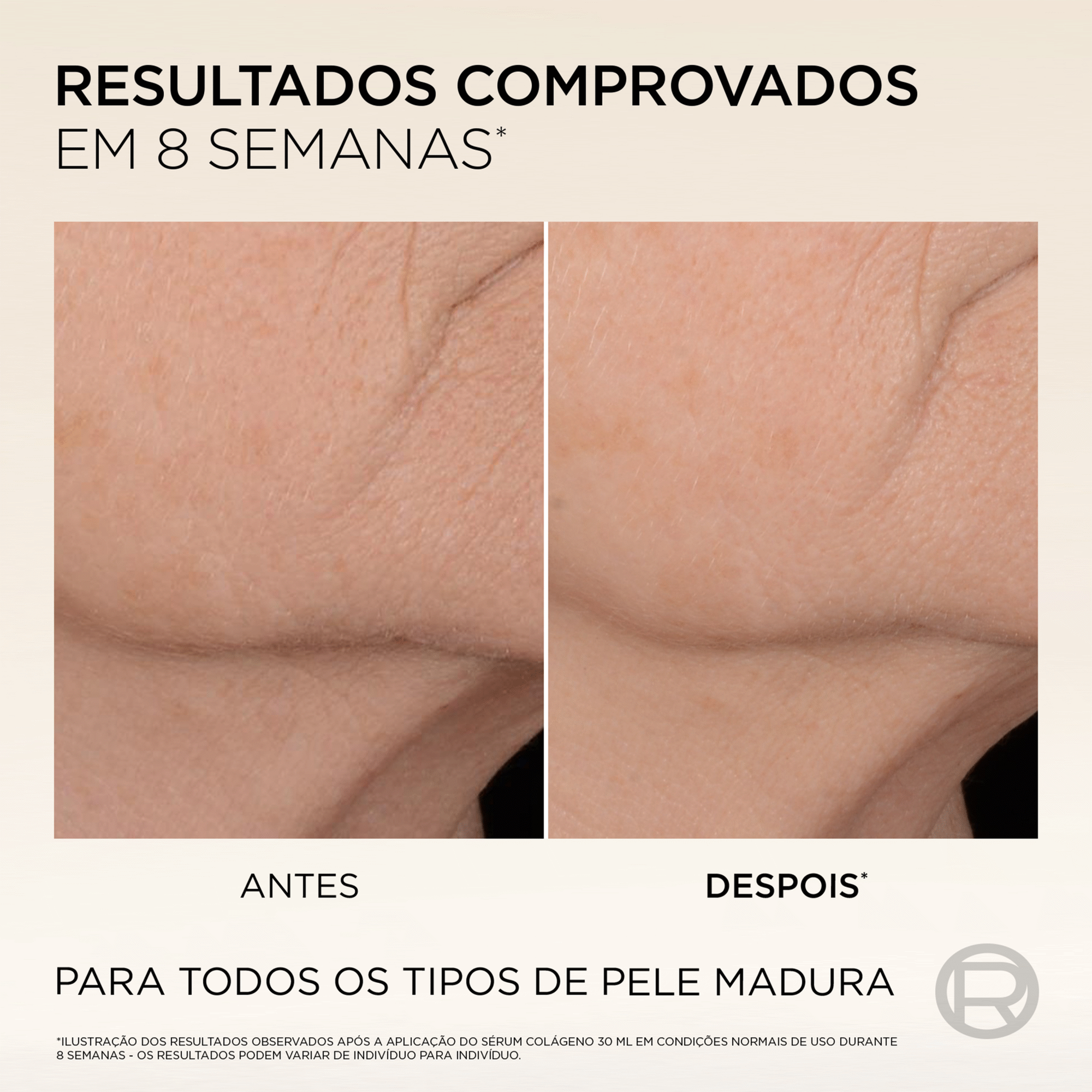 L'Oréal Paris Age Perfect Sérum Antiflacidez 30 ml