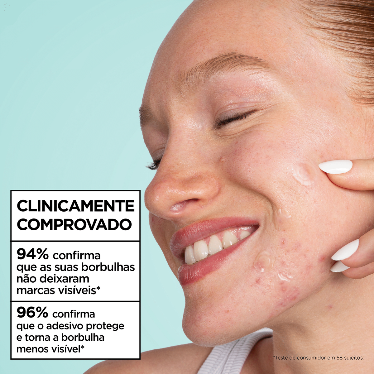 Garnier Skin Active Ultra Pimple Patch 22 ml