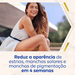 Nivea Luminous 630 Crema Corporal Anti-Estrías y Manchas 200 ml